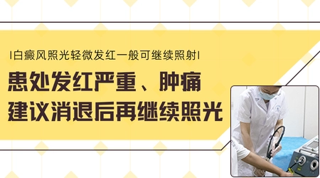 白癜风照光后发红好还是不好
