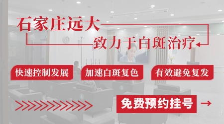 石家庄治白癜风去公立医院还是专科医院