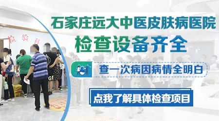 伍德灯能区分白癜风和汗斑吗
