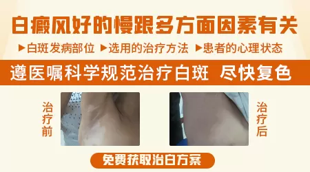 白斑治疗开始见效后来就慢了