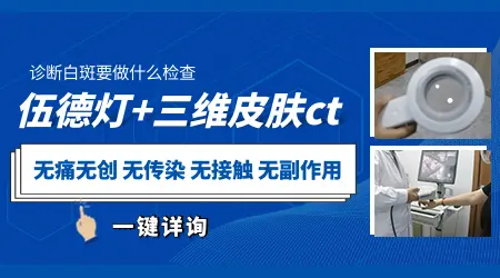 白斑和白癜风误诊案例对比图
