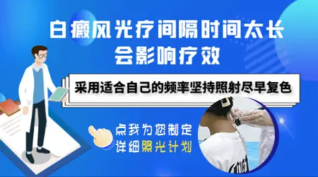 白癜风光疗一次照多长时间合适