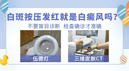 摩擦后白斑部位明显发红是不是白癜风