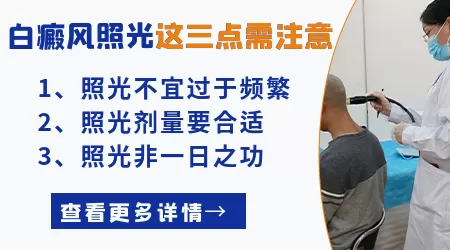 白癜风粘膜部位照射308激光可以吗
