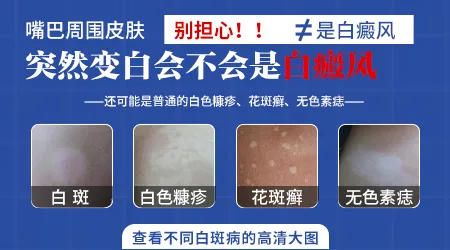 女性嘴角突然白了一片是什么情况