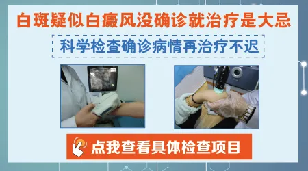身上长白斑之前有过轻微擦伤有关系吗