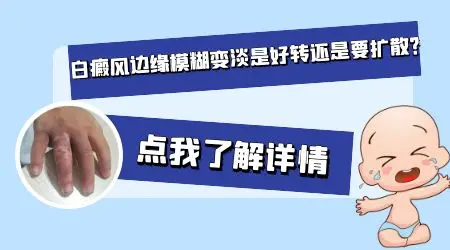 晕痣切除观察多久扩散不扩散