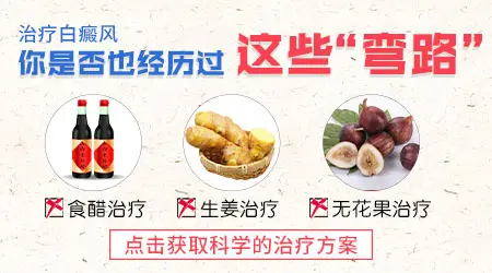 补骨脂用醋泡能治好白癜风吗