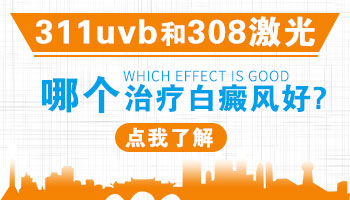 治疗白癜风311uvb好还是308准分子激光好