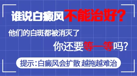 后天性白癜风能治好吗