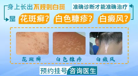 脸上黑一块白一块肤色不均怎么办