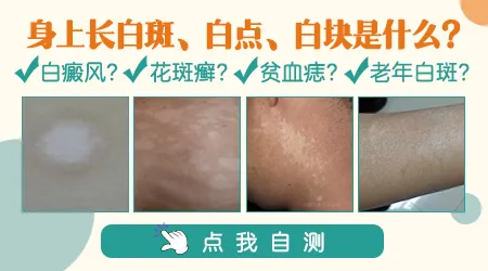 少年腿上一块白是怎么回事