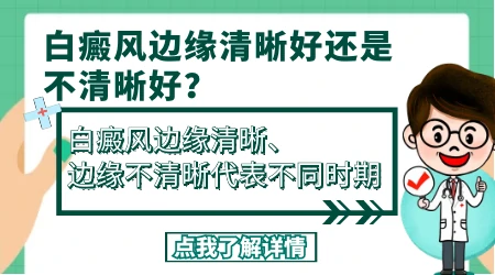 白癜风初期伍德灯边界清晰吗