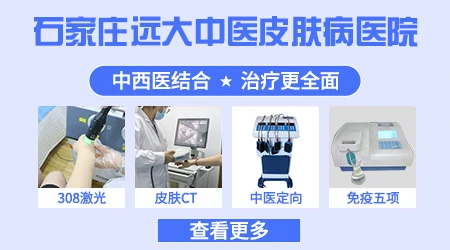 石家庄有没有治疗白癜风的中西医结合医院