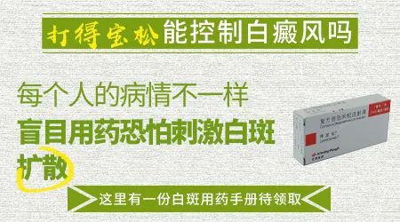 得宝松可以控制白癜风吗