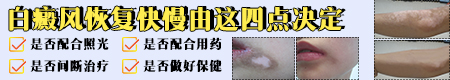 光疗仪可以照射包皮白癜风吗