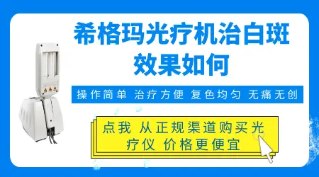 希格玛照白癜风能照好吗