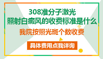 白癜风照射308是如何收费的