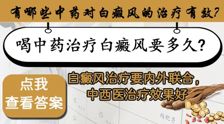 中药治疗白癜风用什么方子好