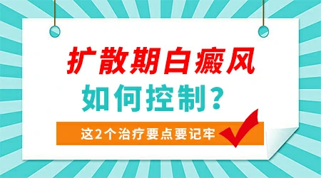 怎么控制白癜风不再扩散发展