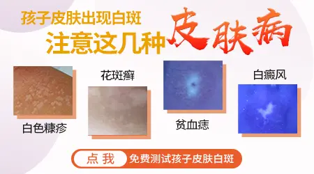 儿童面部白斑早期图片大全