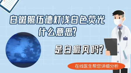 照伍德灯显示淡白色是什么意思