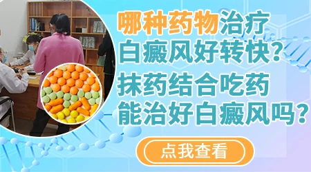 10岁孩子白癜风涂抹什么药膏管用