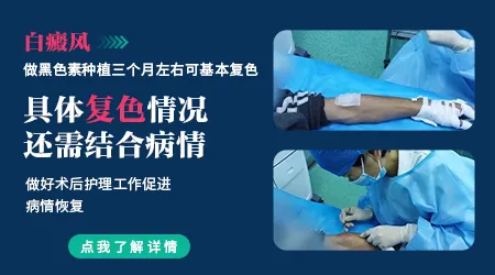 做白癜风手术去石家庄哪家医院好