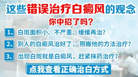 手上白癜风治疗总不见好
