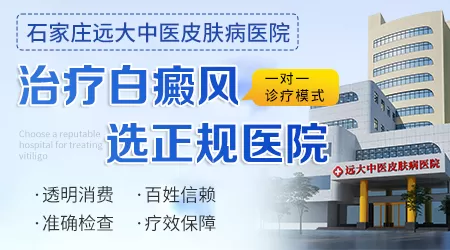 308照光全仓白斑皮肤红发痒怎么办