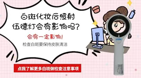 照伍德灯前擦药影响检查结果吗