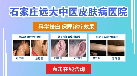 白癜风的发病原因怎么能检查出来
