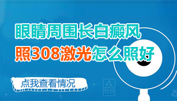 眼睛周边白癜风照308激光对眼睛有伤害吗