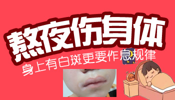 白癜风治疗好还会在复发扩散吗