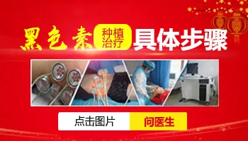 白癜风可以做植皮手术吗 白癜风怎样植皮