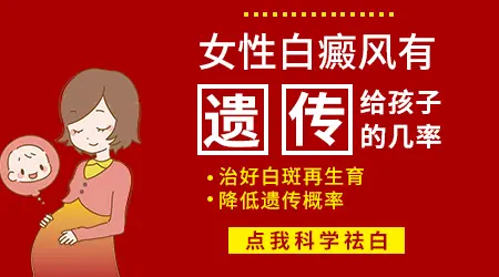 女性白癜风遗传吗 遗传几率大概多少