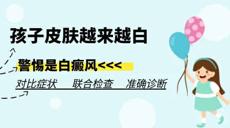 色素脱失越来越白是白癜风吗