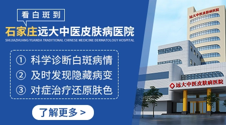 石家庄远大中医皮肤病医院治疗白癜风效果怎么样