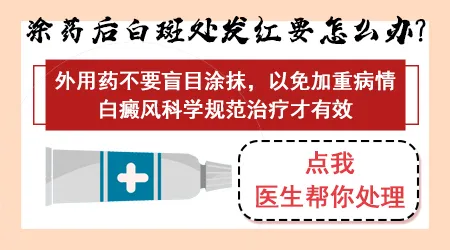 白癜风抹药后有点发红发痒能继续用吗