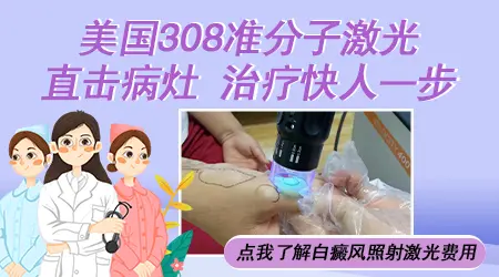 女人乳房白癜风能照光吗