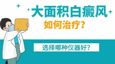 大面积的白癜风用什么方法治