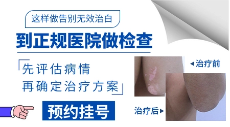 皮肤出现白色斑块是什么