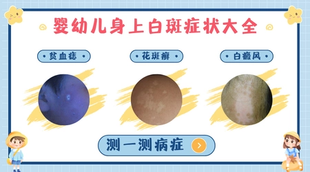 宝宝脖子上出现白斑