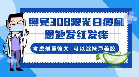 白癜风照完激光后皮肤发红发痒怎么处理