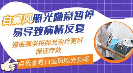白癜风照光过程中能暂停吗