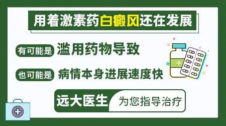 白癜风吃激素还是控制不住怎么办