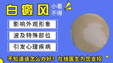 眉毛旁边长白斑是什么原因引起的