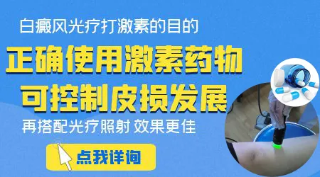 白癜风激素药膏一般用多久会出现副作用