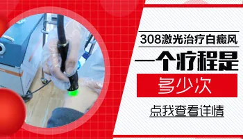 白斑照光几次算一个疗程