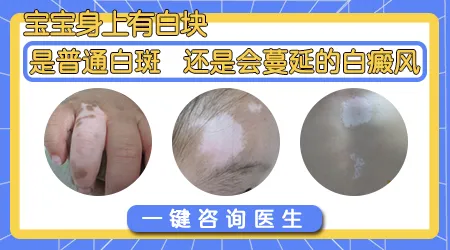 宝宝手指关节处长白块怎么回事